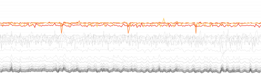 Reliable, machine-learning powered alerts notify you of unusual occurrences.